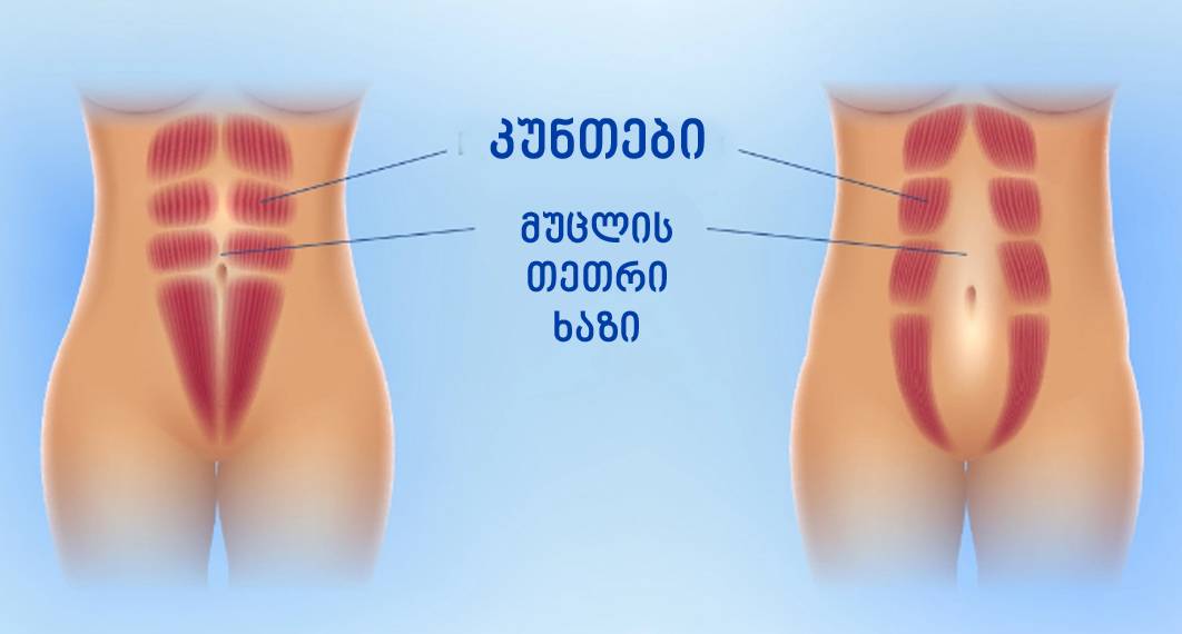 დიასტაზი, 