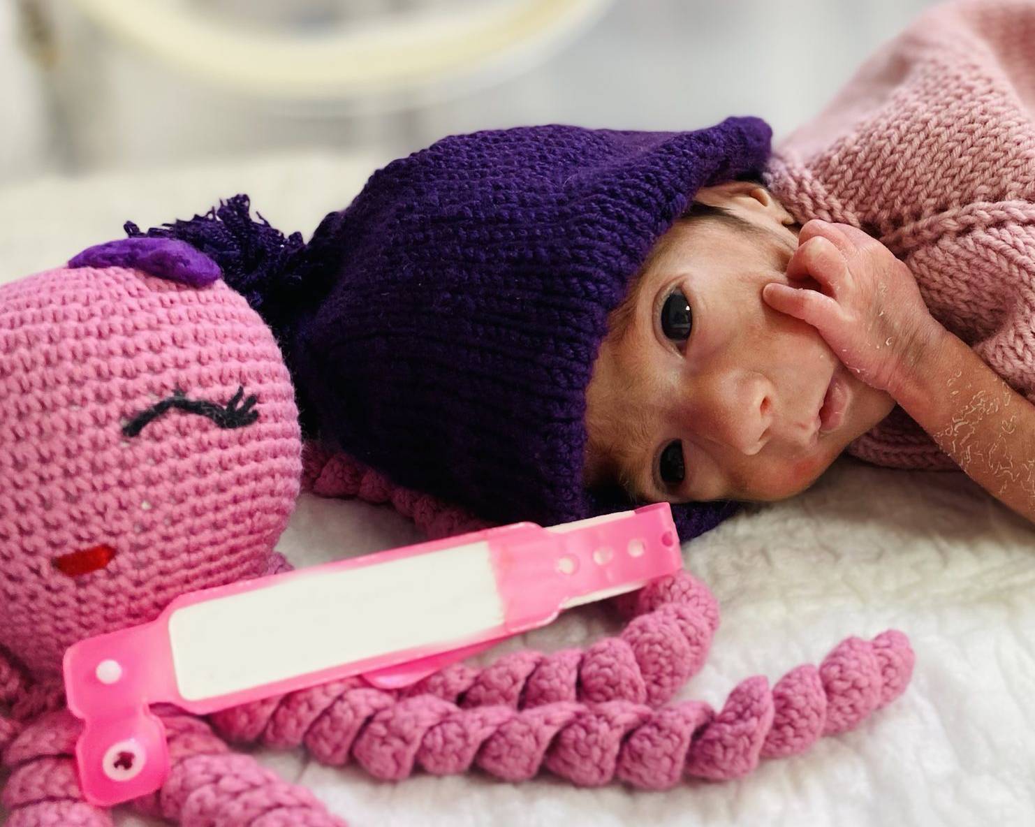 NICU, დღენაკლული, დღენაკლი, 