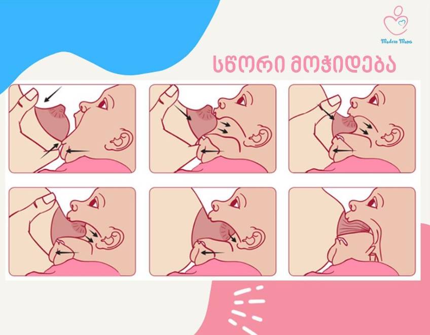 სწორი მოჭიდება, 