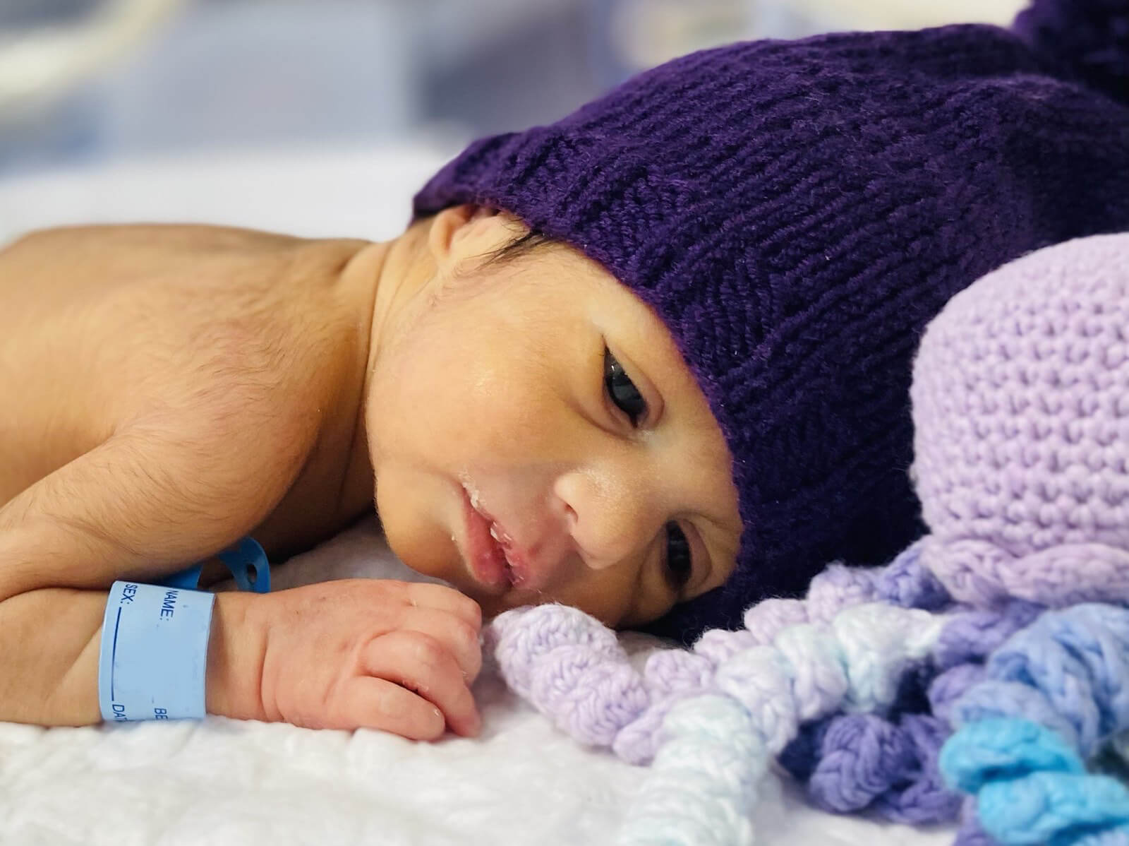 NICU, დღენაკლული, დღენაკლი, 