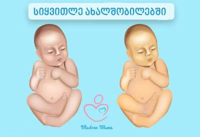 სიყვითლე, ბილირუბინი, 