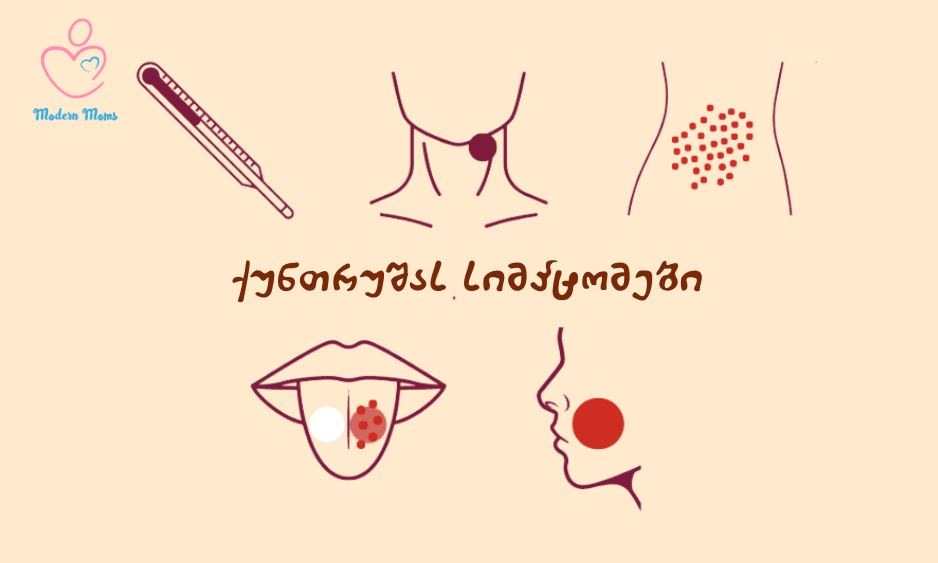 ქუნთრუშას სიმპტომები