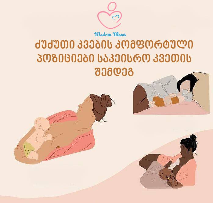 ძუძუთი კვება საკეიროს შემდეგ, ძუძუთი კვება, საკეისრო კვეთა, 