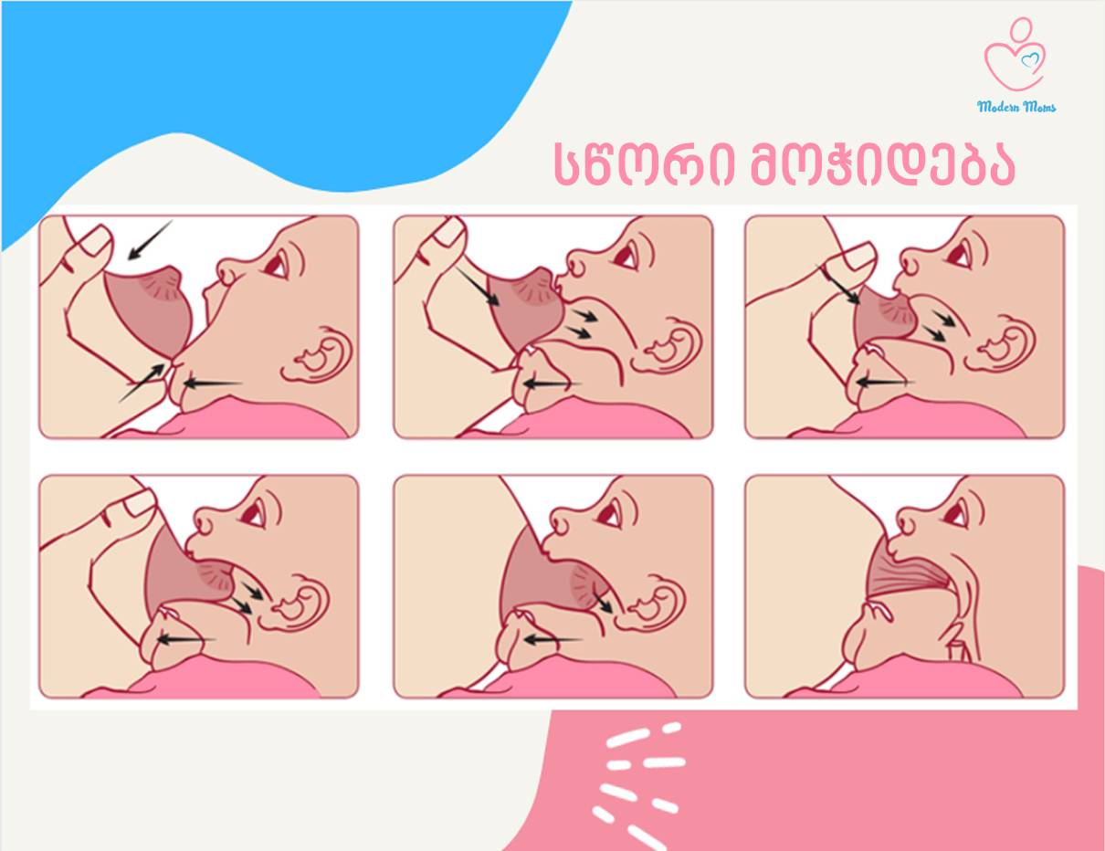 სწორი მოჭიდება, ძუძთი კვება, 